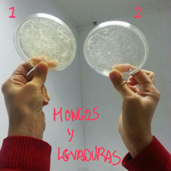 an&aacute;lisis de hongos y levadureas de Fusarium