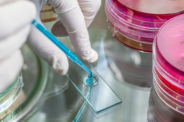 control legionella