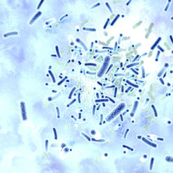 Control y prevenci&oacute;n de la Legionella