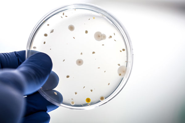 como prevenir la listeria