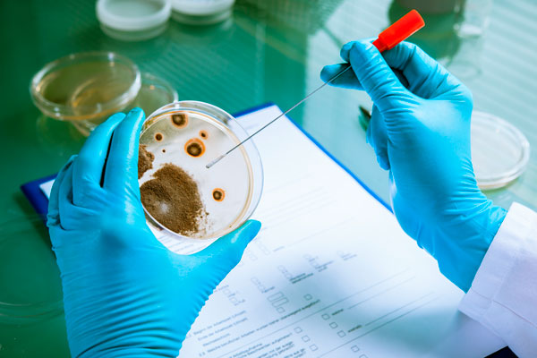 como prevenir la salmonella